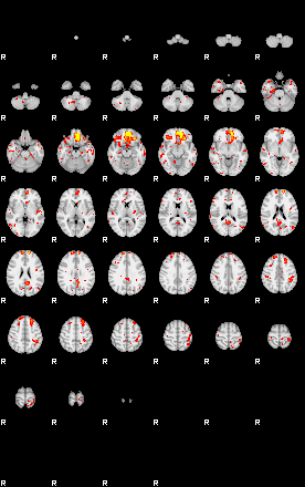 Patient:51;component:144