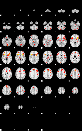 Patient:51;component:151