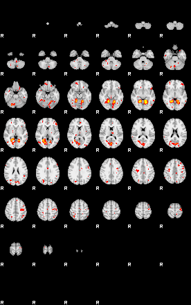 Patient:51;component:161