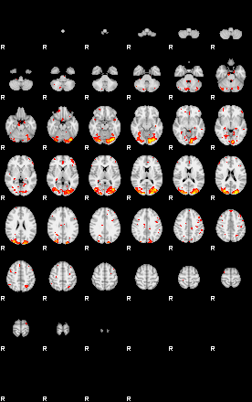 Patient:51;component:171