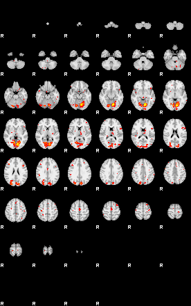 Patient:51;component:191