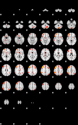 Patient:51;component:25