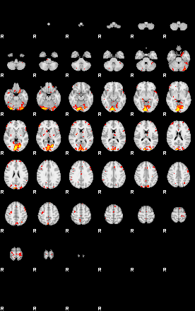 Patient:51;component:30