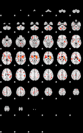 Patient:51;component:39