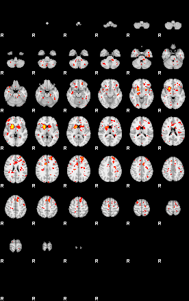 Patient:51;component:42