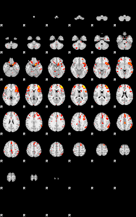 Patient:51;component:43