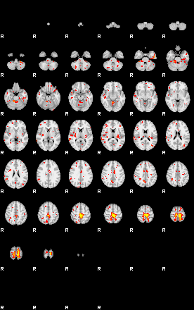 Patient:51;component:55