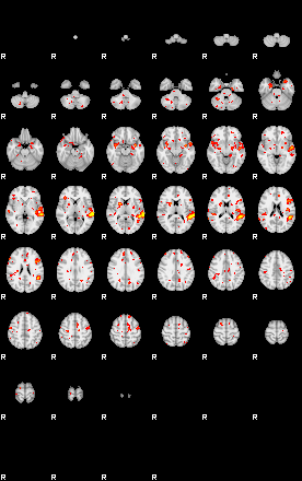 Patient:51;component:56