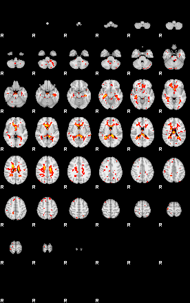 Patient:51;component:57