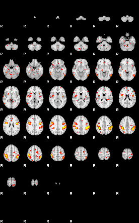 Patient:51;component:75