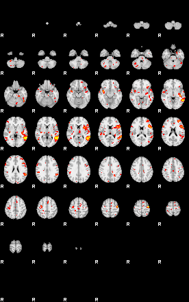 Patient:51;component:9