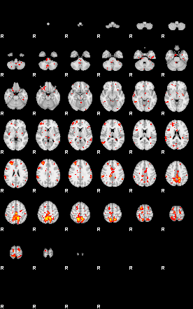 Patient:51;component:91