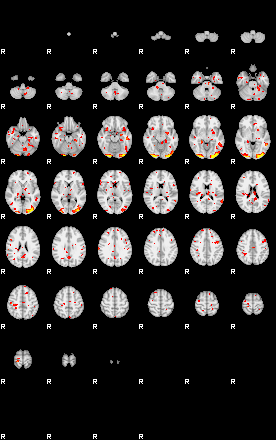 Patient:52;component:111