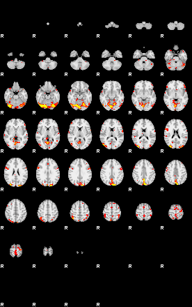 Patient:52;component:126