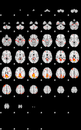 Patient:52;component:142