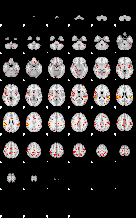 Patient:52;component:150