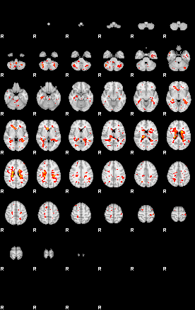 Patient:52;component:16