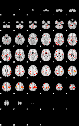 Patient:52;component:21