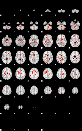 Patient:52;component:33