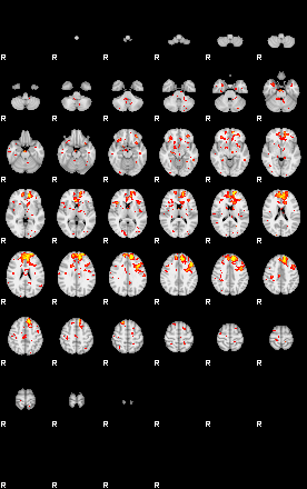 Patient:52;component:44