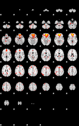 Patient:52;component:49