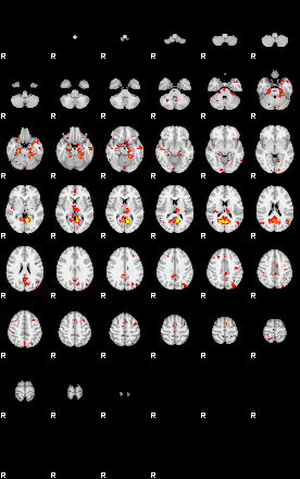 Patient:52;component:5