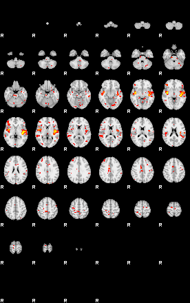 Patient:52;component:58