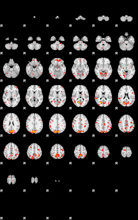 Patient:52;component:84