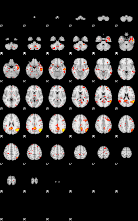 Patient:52;component:93