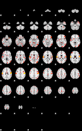 Patient:52;component:96