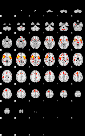 Patient:53;component:151