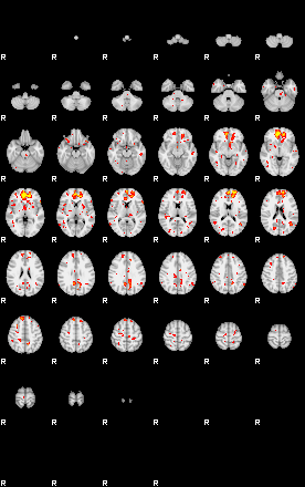 Patient:53;component:49