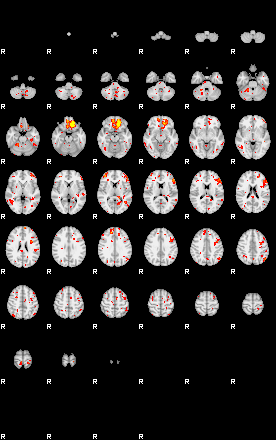 Patient:54;component:113