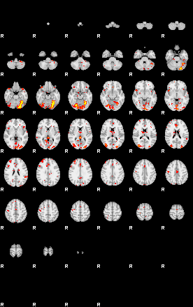 Patient:54;component:122