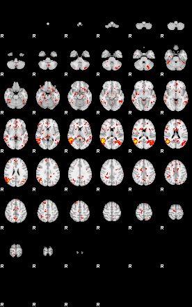 Patient:54;component:142