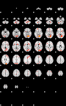 Patient:54;component:191