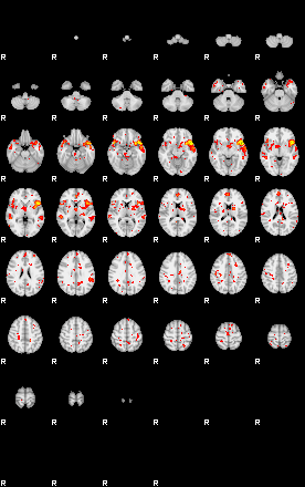 Patient:54;component:41