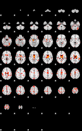 Patient:54;component:47