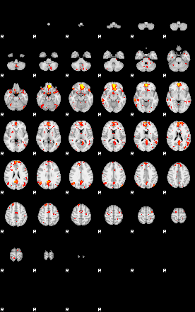 Patient:54;component:49