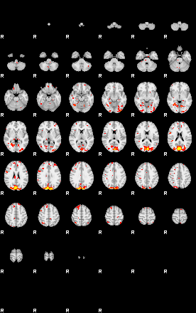 Patient:55;component:102