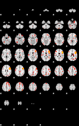 Patient:55;component:109