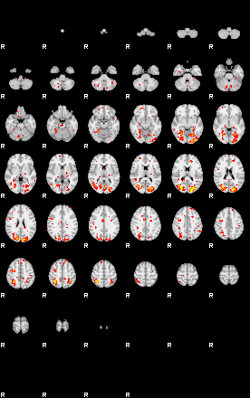 Patient:55;component:111