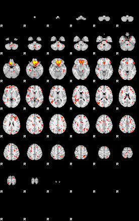 Patient:55;component:113