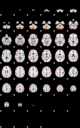 Patient:55;component:114