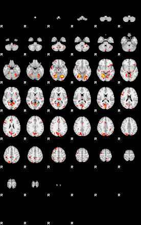 Patient:55;component:126