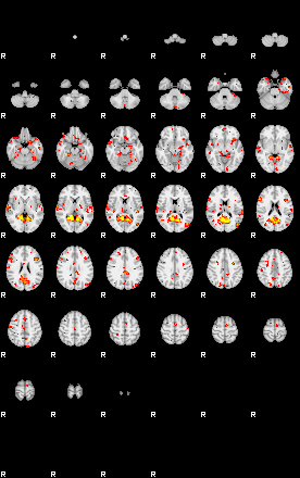 Patient:55;component:161