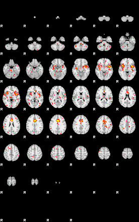 Patient:55;component:195