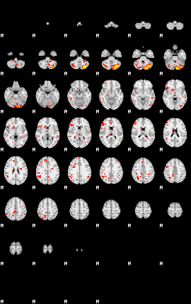 Patient:55;component:198