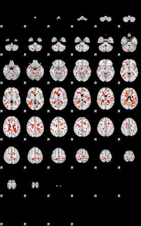 Patient:55;component:20