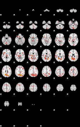 Patient:55;component:29